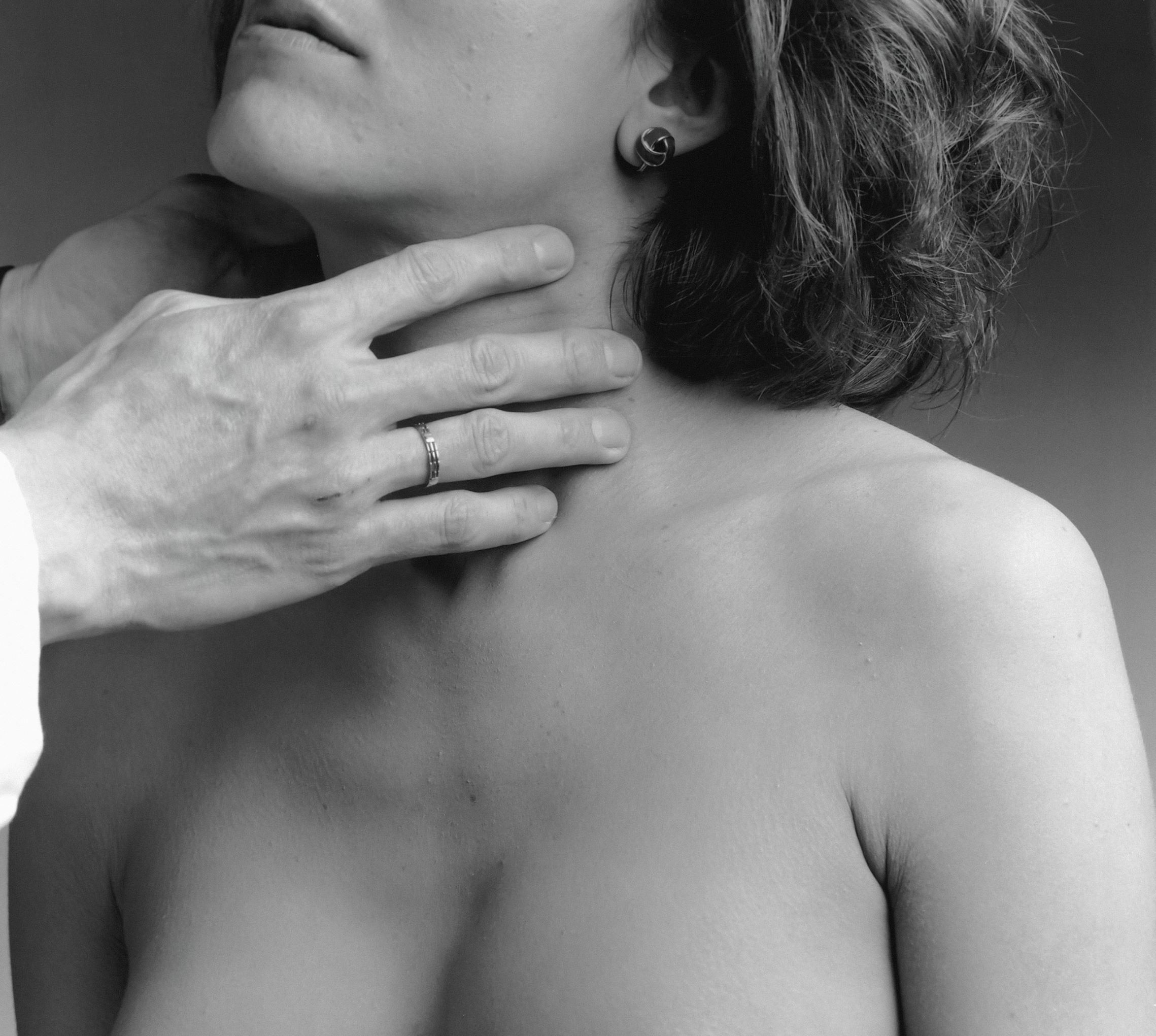 Understanding Hypothyroidism: Causes, Symptoms, and Treatment Options